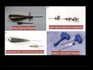 Klima Sternal Needle Salah Bone Marrow Aspiration
Watherfield Iliac Crest Bone Aspiration
Modern Jamshidi Needle
 