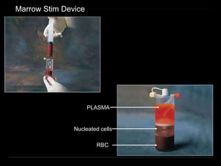 Marrow Stim Device
PLASMA
Nucleated cells
RBC
 