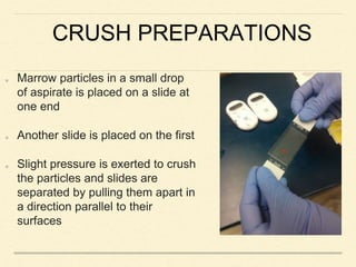 CRUSH PREPARATIONS
Marrow particles in a small drop
of aspirate is placed on a slide at
one end
Another slide is placed on the first
Slight pressure is exerted to crush
the particles and slides are
separated by pulling them apart in
a direction parallel to their
surfaces
 