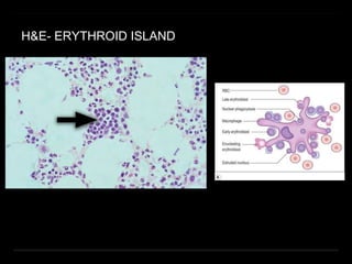 H&E- ERYTHROID ISLAND
 