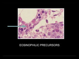 EOSINOPHILIC PRECURSORS
 