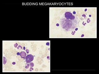 BUDDING MEGAKARYOCYTES
 