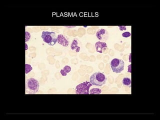PLASMA CELLS
 