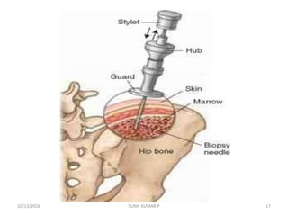 Bone Marrow Examination, BMA | PPTX