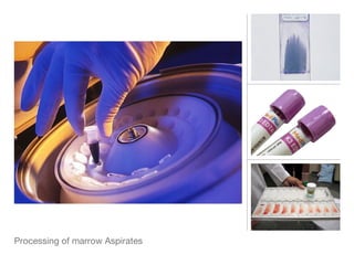 Processing of marrow Aspirates
 