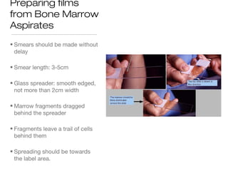 Preparing films
from Bone Marrow
Aspirates
• Smears should be made without
delay
• Smear length: 3-5cm
• Glass spreader: smooth edged,
not more than 2cm width
• Marrow fragments dragged
behind the spreader
• Fragments leave a trail of cells
behind them
• Spreading should be towards
the label area.
 