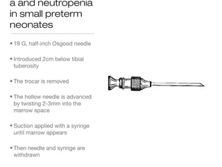a and neutropenia
in small preterm
neonates
• 19 G, half-inch Osgood needle
• Introduced 2cm below tibial
tuberosity
• The trocar is removed
• The hollow needle is advanced
by twisting 2-3mm into the
marrow space
• Suction applied with a syringe
until marrow appears
• Then needle and syringe are
withdrawn
 