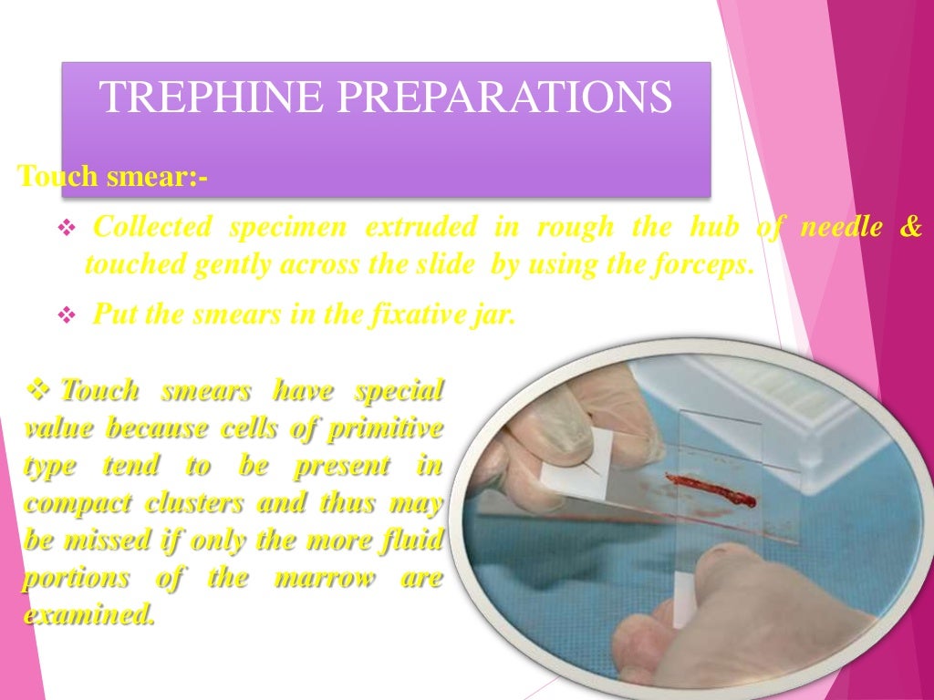 Bone marrow aspiration & trephine biopsy