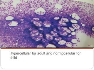Hypercellular Bone marrow biopsy | PPTX