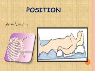 POSITION
Sternal punture
 