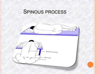 SPINOUS PROCESS
 