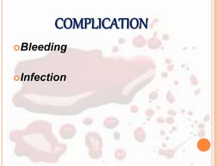 COMPLICATION
Bleeding
Infection
 