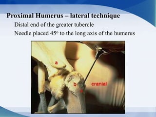 Proximal Humerus – lateral technique
Distal end of the greater tubercle
Needle placed 45o to the long axis of the humerus
 