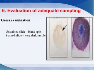 6. Evaluation of adequate sampling
Gross examination
Unstained slide – blank spot
Stained slide – very dark purple spot
 