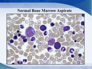 Normal Bone Marrow Aspirate
 