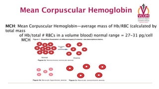 Mean Corpuscular Hemoglobin

MCH: Mean Corpuscular Hemoglobin—average mass of Hb/RBC (calculated by
total mass
       of Hb/total # RBCs in a volume blood) normal range = 27-31 pg/cell

       MCH is reduced in hypochromic anemias
 