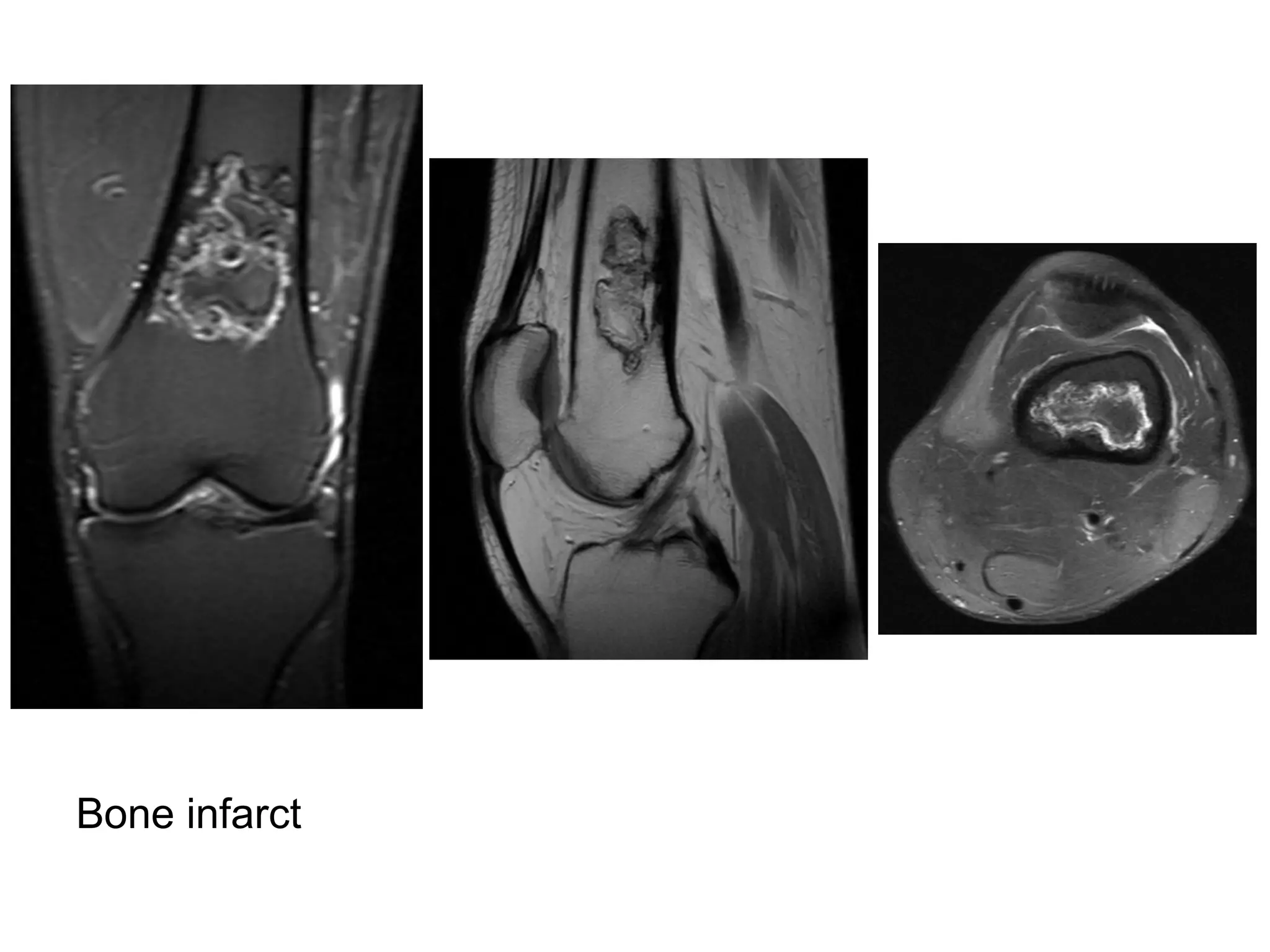 Diagnositc Imaging of Bone Marrow Disease | PPT