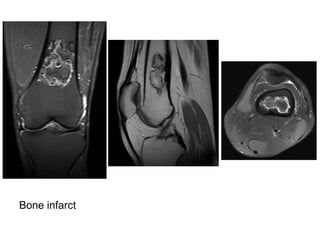Diagnositc Imaging of Bone Marrow Disease | PPT