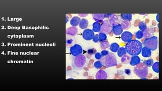 1. Large
2. Deep Basophilic
cytoplasm
3. Prominent nucleoli
4. Fine nuclear
chromatin
 