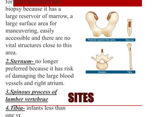 SITES
for both aspiration and
biopsy because it has a
large reservoir of marrow, a
large surface area for
maneuvering, easily
accessible and there are no
vital structures close to this
area.
2.Sternum- no longer
preferred because it has risk
of damaging the large blood
vessels and right atrium.
3.Spinous process of
lumber vertebrae
4.Tibia- infants less than
one yr
 
