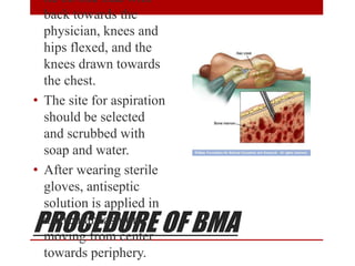 PROCEDURE OF BMA
lie on one side with
back towards the
physician, knees and
hips flexed, and the
knees drawn towards
the chest.
• The site for aspiration
should be selected
and scrubbed with
soap and water.
• After wearing sterile
gloves, antiseptic
solution is applied in
a circular fashion,
moving from center
towards periphery.
 