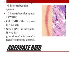 ADEQUATE BMB
• 1.5 cm to 2 cm in length,
>5 inter trabecular
spaces.
• 10 intertrabecular space
s (WHO)
• C/L BMB if the first one
is <1.6 cm
• Small BMB is adequate
if +ve for
granuloma/metastasis/fu
ngus/lymphoma deposit.
 