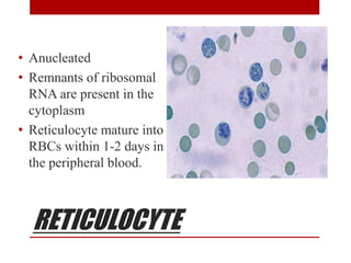 RETICULOCYTE
• Anucleated
• Remnants of ribosomal
RNA are present in the
cytoplasm
• Reticulocyte mature into
RBCs within 1-2 days in
the peripheral blood.
 