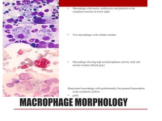 MACROPHAGE MORPHOLOGY
• Macrophage with nuclei, erythrocytes and platelets in the
cytoplasm (nucleus at lower right)
• Two macrophages with cellular residues
• Macrophage showing high acid phosphatase activity (red) and
nuclear residues (bluish gray)
Binucleated macrophage with predominantly fine-grained hemosiderin
in the cytoplasm (yellow-
• gold)
 