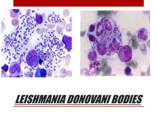 LEISHMANIA DONOVANI BODIES
 