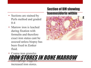 IRON STORES IN BONE MARROW
Section of BM showing
haemosiderin within
macrophages in a patient
with iron overload
• Sections are stained by
Perls method and graded
0-4
• Marrow iron is leached
during fixation with
formalin and therefore
exact iron status cant be
assesed unless biopsy has
been fixed in Zenker
fluid.
• Coarse iron granules
lying free or in
macrophage suggests
increased iron stores.
 