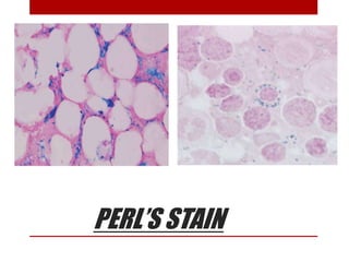 PERL’S STAIN
 
