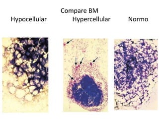 Hypercellular Bone marrow examination in all domestic animals By Dr. Sama Awais Akram ...
