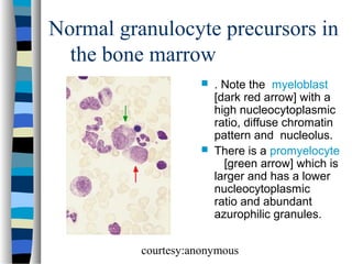 Normal granulocyte precursors in
the bone marrow




. Note the myeloblast
[dark red arrow] with a
high nucleocytoplasmic
ratio, diffuse chromatin
pattern and nucleolus.
There is a promyelocyte
[green arrow] which is
larger and has a lower
nucleocytoplasmic
ratio and abundant
azurophilic granules.

courtesy:anonymous

 