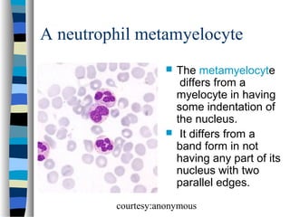 A neutrophil metamyelocyte




The metamyelocyte
differs from a
myelocyte in having
some indentation of
the nucleus.
It differs from a
band form in not
having any part of its
nucleus with two
parallel edges.

courtesy:anonymous

 
