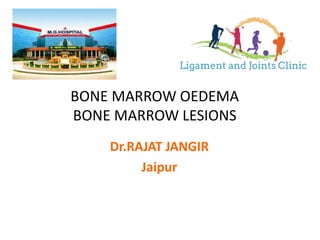 BONE MARROW OEDEMA
BONE MARROW LESIONS
Dr.RAJAT JANGIR
Jaipur
 