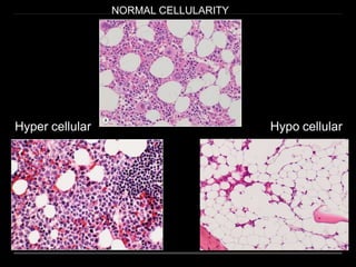 bone marrow ppt.pptx