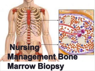 Bone marrow transplantation