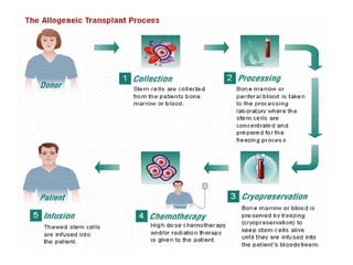 Bone marrow transplantation
