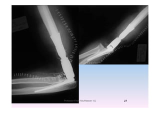 1/14/2011 27Professor Freih AbuHassan -UJ
 