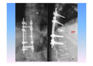 25o25
1/14/2011 39Professor Freih AbuHassan -UJ
 