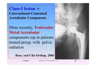 Class-I lesion
Conventional Cemented
Acetabular Component.Acetabular Component.
M l T b lMore recently, Trabecular
Metal Acetabular
components esp in patients
treated preop ith pel ictreated preop. with pelvic
radiation
Rose. etal Clin Orthop. 2006
1/14/2011 45Professor Freih AbuHassan -UJ
 