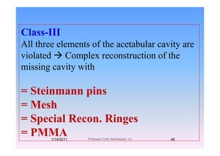 Class-III
All th l t f th t b l itAll three elements of the acetabular cavity are
violated Complex reconstruction of thep
missing cavity with
= Steinmann pinsp
= Mesh
= Special Recon. Ringes
= PMMA= PMMA1/14/2011 48Professor Freih AbuHassan -UJ
 