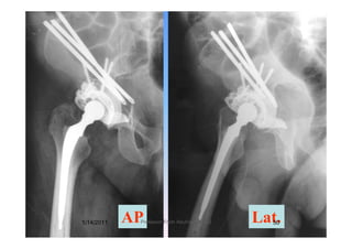 AP Lat.1/14/2011 50Professor Freih AbuHassan -UJ
 