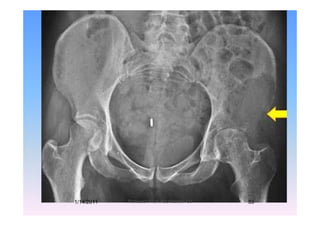 1/14/2011 53Professor Freih AbuHassan -UJ
 