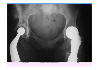 1/14/2011 69Professor Freih AbuHassan -UJ
 