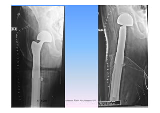 1/14/2011 73Professor Freih AbuHassan -UJ
 