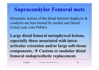 Supracondylar Femoral metsSupracondylar Femoral mets
Metastatic lesions of the distal femoral diaphysis &Metastatic lesions of the distal femoral diaphysis &
condyles are best treated by medial and lateral
Zickel rods with PMMAZickel rods with PMMA.
Large distal femoral metaph seal lesionsLarge distal femoral metaphyseal lesions,
especially those associated with intra-p y
articular extension and/or large soft-tissue
components Custom or modular distalcomponents, Custom or modular distal
femoral endoprosthetic replacement.
1/14/2011 76Professor Freih AbuHassan -UJ
 