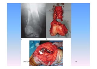 1/14/2011 77Professor Freih AbuHassan -UJ
 