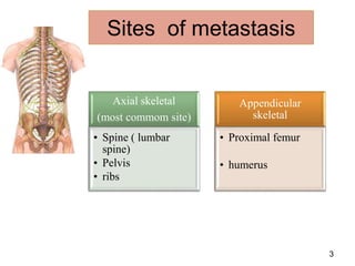 Bone Mets Types Bone metastasis | PPT