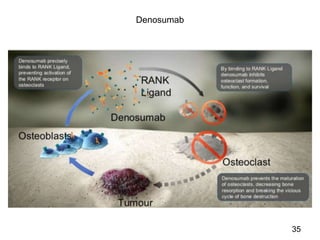 Bone Mets Types Bone metastasis | PPT